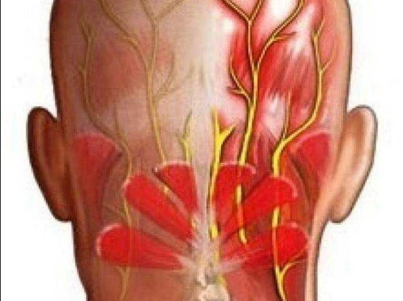 Ανεύρυσμα Ιγνυακής Αρτηρίας