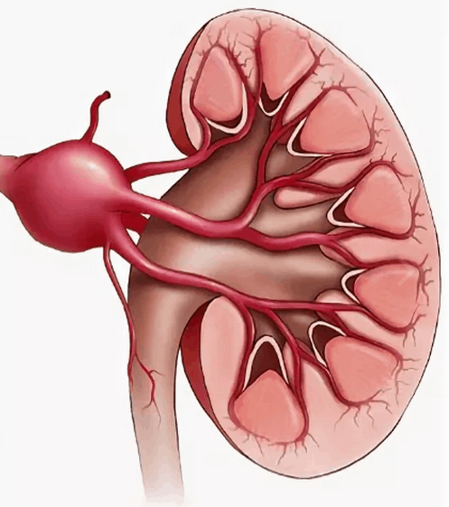 Ανεύρυσμα νεφρικής αρτηρίας