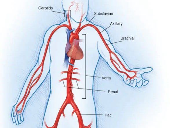 Αρτηριακές παθήσεις άνω άκρου