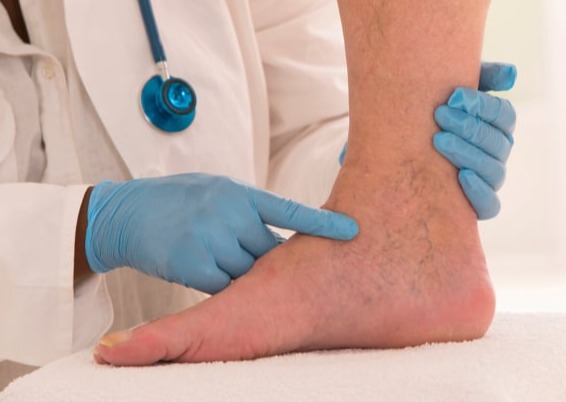 Επιπολής (Επιφανειακή)