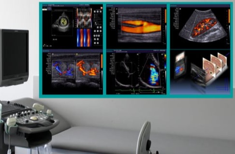 ΔΙΑΓΝΩΣΤΙΚΕΣ ΕΞΕΤΑΣΕΙΣ Αρτηριών