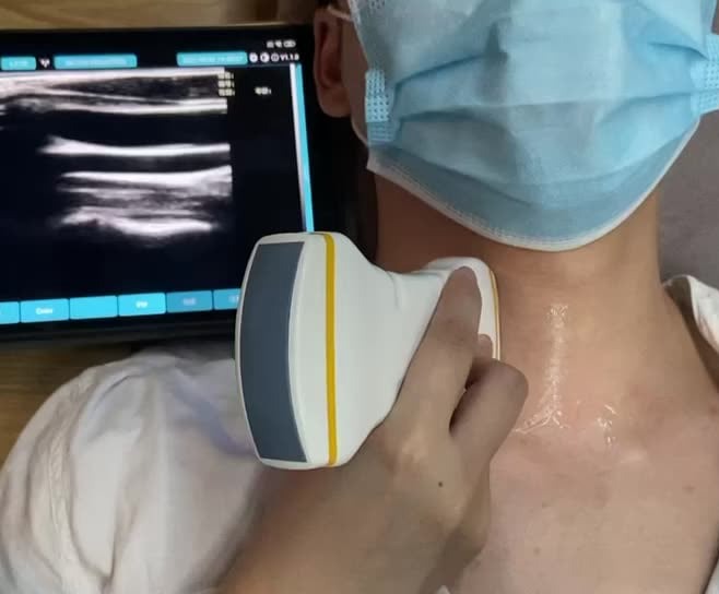 ΔΙΑΓΝΩΣΤΙΚΕΣ ΕΞΕΤΑΣΕΙΣ Καρωτίδων Αρτηριών