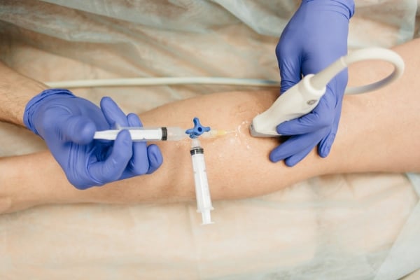 Μικροσκληροθεραπεία